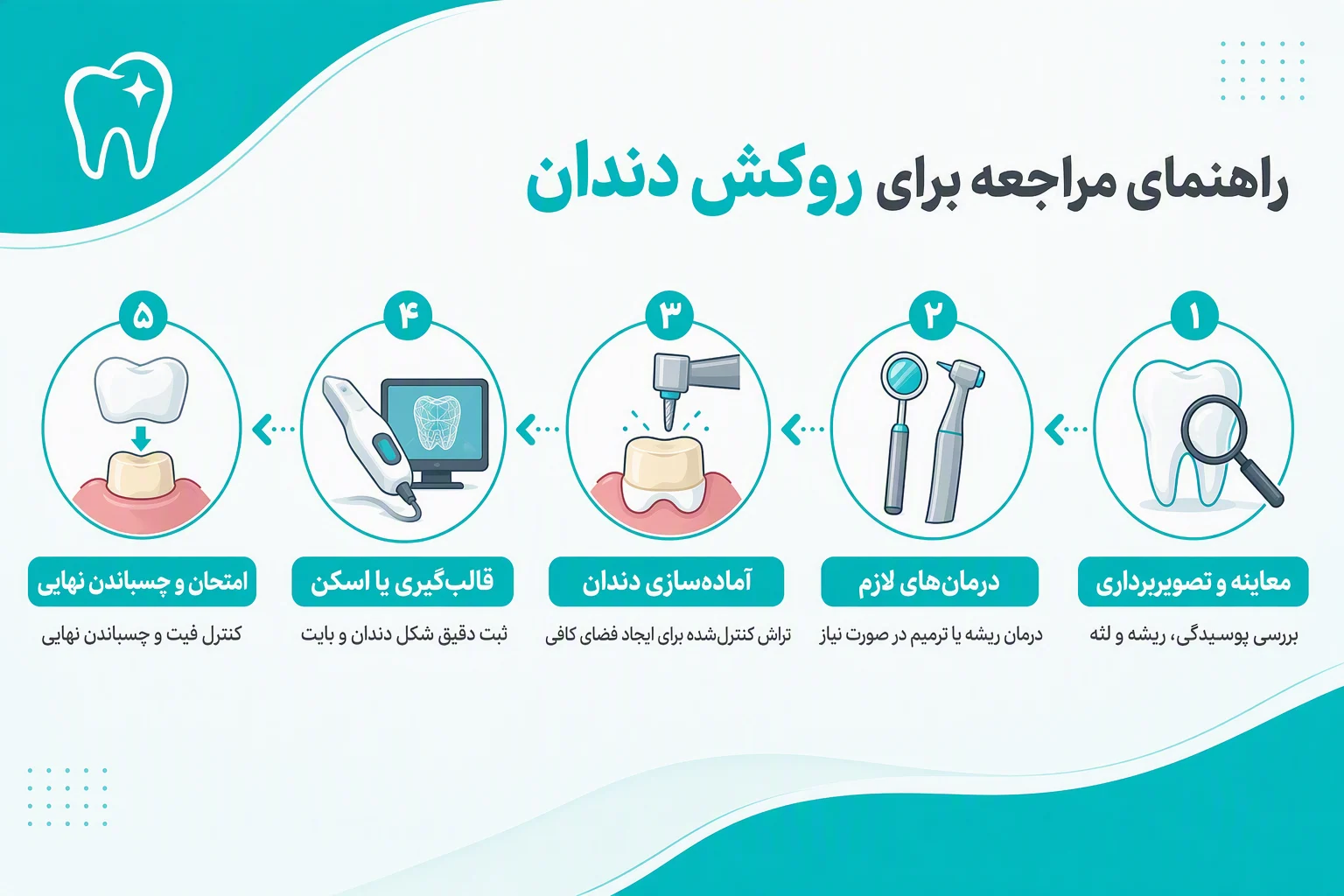 اینفوگرافیک راهنمای مراجعه برای روکش دندان شامل معاینه، آماده‌سازی، اسکن و چسباندن روکش