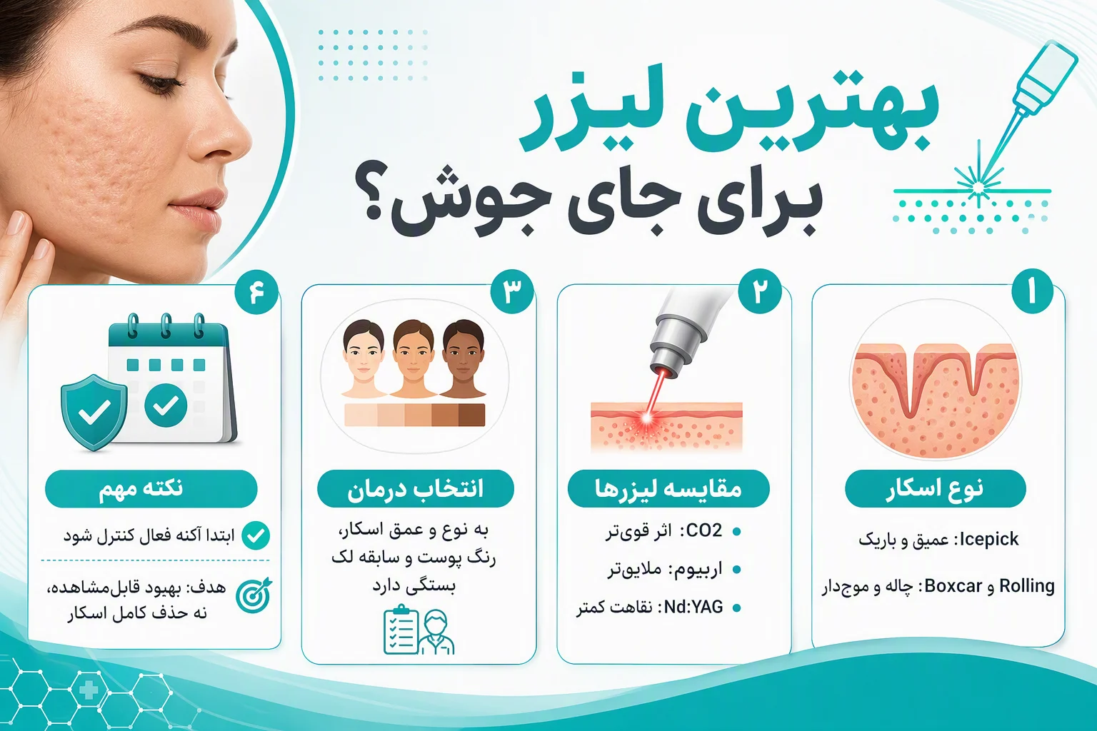 اینفوگرافیک مقایسه لیزرهای CO2، اربیوم و Nd:YAG برای درمان جای جوش و اسکار آکنه